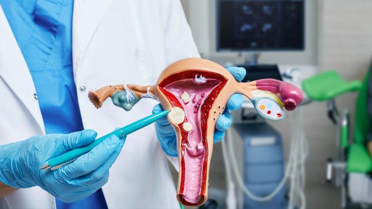 How to Spot Early Signs of Uterine Fibroids and Seek Treatment